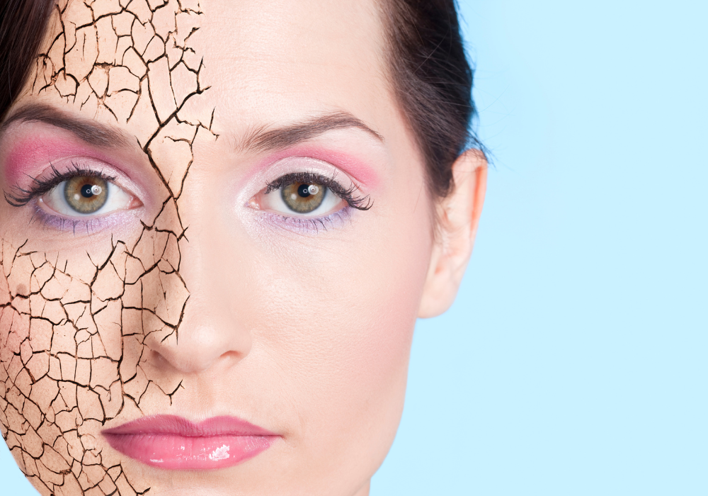 dry skin